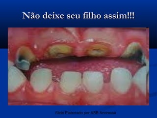 Não deixe seu filho assim!!!




        Slide Elaborado por ASB Andressa
 