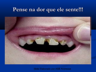Pense na dor que ele sente!!!




        Slide Elaborado por ASB Andressa
 