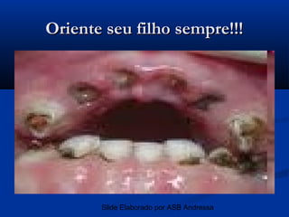 Oriente seu filho sempre!!!




       Slide Elaborado por ASB Andressa
 