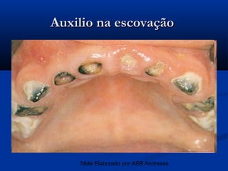 Auxilio na escovação




    Slide Elaborado por ASB Andressa
 