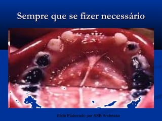 Sempre que se fizer necessário




         Slide Elaborado por ASB Andressa
 