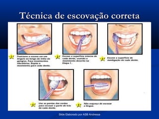 Técnica de escovação correta

Slide Elaborado por ASB Andressa

 