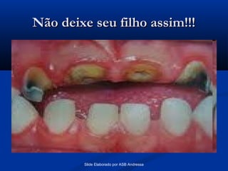 Não deixe seu filho assim!!!

Slide Elaborado por ASB Andressa

 