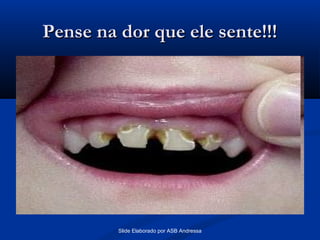 Pense na dor que ele sente!!!

Slide Elaborado por ASB Andressa

 