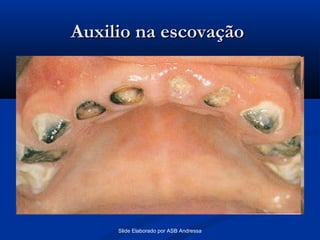 Auxilio na escovação

Slide Elaborado por ASB Andressa

 