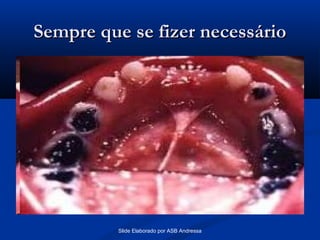 Sempre que se fizer necessário

Slide Elaborado por ASB Andressa

 