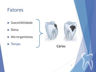 Fatores


Suscetibilidade



Dieta



Microrganismos



Tempo

Cáries

10

 
