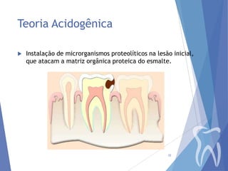 Teoria Acidogênica


Instalação de microrganismos proteolíticos na lesão inicial,
que atacam a matriz orgânica proteica do esmalte.

22

 