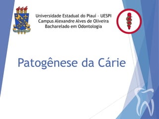 Universidade Estadual do Piauí – UESPI
Campus Alexandre Alves de Oliveira
Bacharelado em Odontologia

Patogênese da Cárie

 