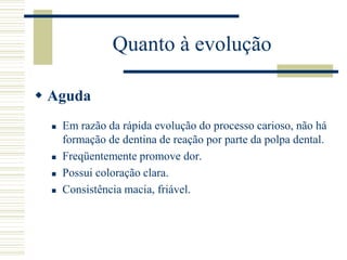 Quanto à evolução

 Aguda
     Em razão da rápida evolução do processo carioso, não há
      formação de dentina de reação por parte da polpa dental.
     Freqüentemente promove dor.
     Possui coloração clara.
     Consistência macia, friável.
 