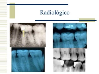 Radiológico
 