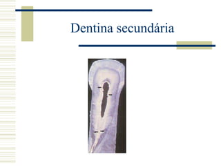 Dentina secundária
 