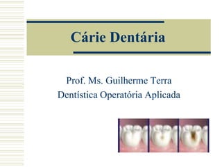 Cárie Dentária

 Prof. Ms. Guilherme Terra
Dentística Operatória Aplicada
 