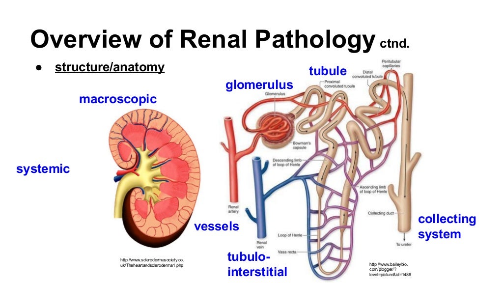 Renal Pathology Tutorial