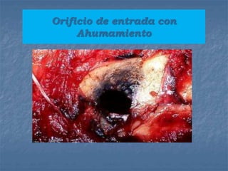 Orificio de entrada con
Ahumamiento
 
