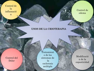 Control de
la
inflamació
n
Control de
edema
Control del
Dolor
Modificació
n de la
espasticidad
Tratamient
o de los
síntomas de
la
esclerosis
múltiple
USOS DE LA CRIOTERAPIAUSOS DE LA CRIOTERAPIA
 