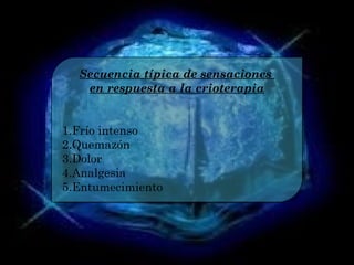 Secuencia típica de sensaciones
en respuesta a la crioterapia
1.Frío intenso
2.Quemazón
3.Dolor
4.Analgesia
5.Entumecimiento
Secuencia típica de sensaciones
en respuesta a la crioterapia
1.Frío intenso
2.Quemazón
3.Dolor
4.Analgesia
5.Entumecimiento
 