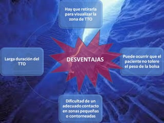 DESVENTAJAS
 