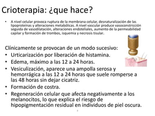 Crioterapia: ¿que hace?
• A nivel celular provoca ruptura de la membrana celular, desnaturalización de las
lipoproteínas y alteraciones metabólicas. A nivel vascular produce vasoconstricción
seguida de vasodilatación, alteraciones endoteliales, aumento de la permeabilidad
capilar y formación de trombos, isquemia y necrosis tisular.
Clínicamente se provocan de un modo sucesivo:
• Urticarización por liberación de histamina.
• Edema, máximo a las 12 a 24 horas.
• Vesiculización, aparece una ampolla serosa y
hemorrágica a las 12 a 24 horas que suele romperse a
las 48 horas sin dejar cicatriz.
• Formación de costra.
• Regeneración celular que afecta negativamente a los
melanocitos, lo que explica el riesgo de
hipopigmentación residual en individuos de piel oscura.
4
 
