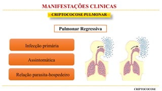 CRIPTOCOCOSE
CRIPTOCOCOSE PULMONAR
MANIFESTAÇÕES CLINICAS
Relação parasita-hospedeiro
Assintomática
Infecção primária
Pulmonar Regressiva
 