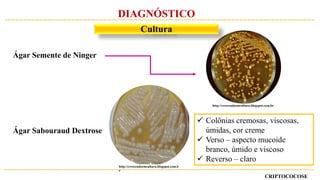 Ágar Semente de Ninger
Ágar Sabouraud Dextrose
 Colônias cremosas, viscosas,
úmidas, cor creme
 Verso – aspecto mucoide
branco, úmido e viscoso
 Reverso – claro
http://crescendoemcultura.blogspot.com.br
http://crescendoemcultura.blogspot.com.b
r
CRIPTOCOCOSE
DIAGNÓSTICO
Cultura
 