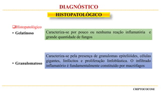 Histopatológico
• Gelatinoso
• Granulomatoso
Caracteriza-se por pouco ou nenhuma reação inflamatória e
grande quantidade de fungos
Caracteriza-se pela presença de granulomas epitelióides, células
gigantes, linfócitos e proliferação linfoblástica. O infiltrado
inflamatório é fundamentalmente constituído por macrófagos
CRIPTOCOCOSE
DIAGNÓSTICO
HISTOPATOLÓGICO
 