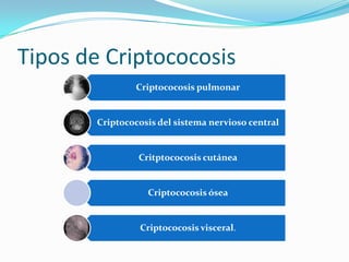 Tipos de Criptococosis
Criptococosis pulmonar

Criptococosis del sistema nervioso central

Critptococosis cutánea

Criptococosis ósea

Criptococosis visceral.

 