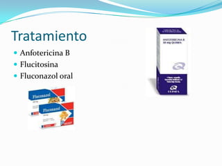 Tratamiento
 Anfotericina B
 Flucitosina
 Fluconazol oral

 