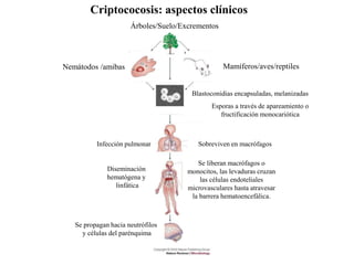 Infección pulmonar
Diseminación
hematógena y
linfática
Árboles/Suelo/Excrementos
Sobreviven en macrófagos
Se liberan macrófagos o
monocitos, las levaduras cruzan
las células endoteliales
microvasculares hasta atravesar
la barrera hematoencefálica.
Blastoconidias encapsuladas, melanizadas
Esporas a través de apareamiento o
fructificación monocariótica
Criptococosis: aspectos clínicos
Nemátodos /amibas Mamíferos/aves/reptiles
Se propagan hacia neutrófilos
y células del parénquima
 