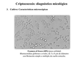 Criptococosis: diagnóstico micológico
Examen al fresco (40X) (poca utilidad)
Blastoconidias globosas u ovales, de 3 a 8 µm de diámetro
con Brotación simple o múltiple de cuello estrecho.
3. Cultivo: Características microscópicas
 