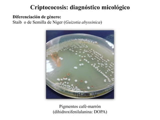 Criptococosis: diagnóstico micológico
Diferenciación de género:
Staib o de Semilla de Niger (Guizotia abyssinica)
Pigmentos café-marrón
(dihidroxifenilalanina: DOPA)
 