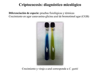 Criptococosis: diagnóstico micológico
Crecimiento y viraje a azul corresponde a C. gattii
Diferenciación de especie: pruebas fisiológicas y térmicas
Crecimiento en agar canavanina-glicina azul de bromotimol agar (CGB)
 