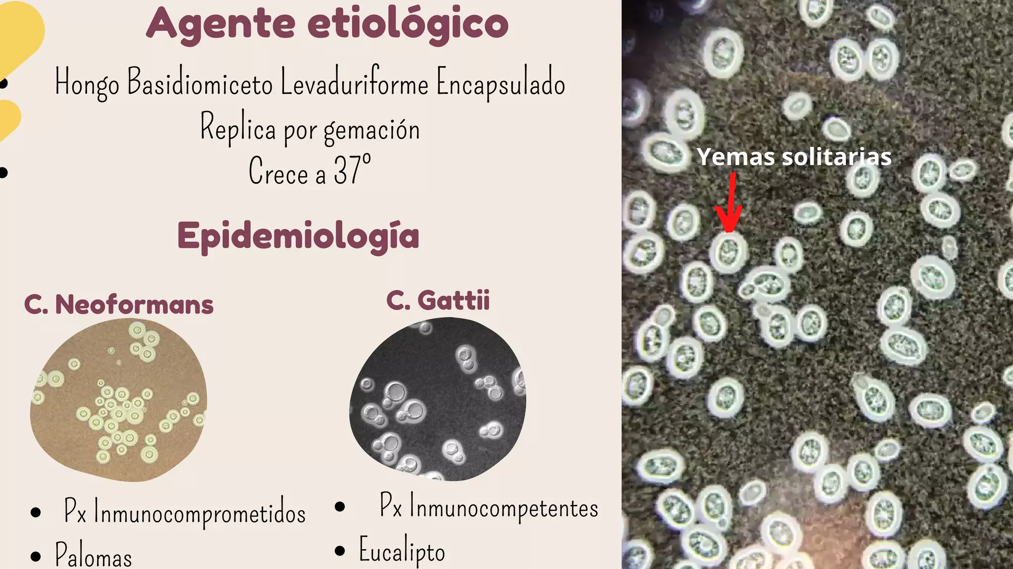 Criptococosis.pdf