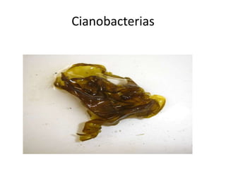 Cianobacterias
 