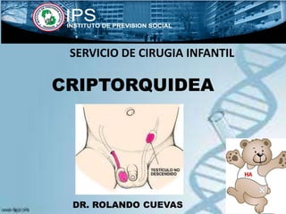 CRIPTORQUIDEA
DR. ROLANDO CUEVAS
SERVICIO DE CIRUGIA INFANTIL
 