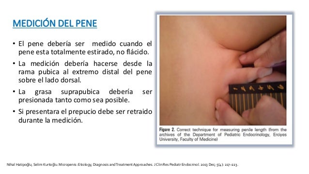 Sobre la cabeza del miembro pequeño las ampollas