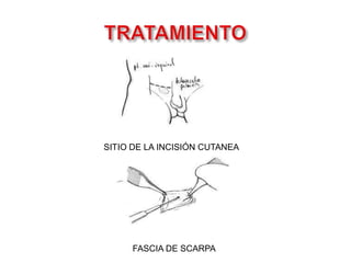 CAMBIOS HISTOLOGICOSDESPUES 1 MES:       Células de Leydig