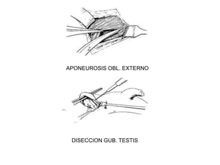DESPUES 6 MES:	 Volumen Espermatogonias.
