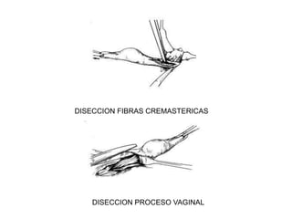 DESPUES 1 AÑO:	Fibrosis Peritubular.