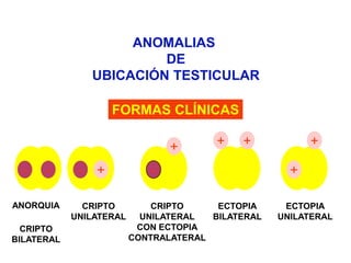 ++++---+-+ANORQUIACRIPTOUNILATERALCRIPTOUNILATERALCON ECTOPIACONTRALATERALECTOPIABILATERALECTOPIAUNILATERALCRIPTOBILATERALANOMALIAS DEUBICACIÓN TESTICULARFORMAS CLÍNICAS