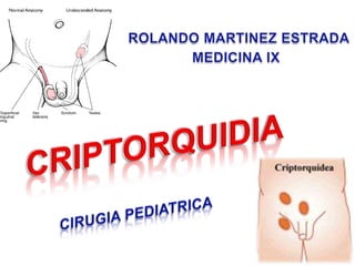 ROLANDO MARTINEZ ESTRADA MEDICINA IX CRIPTORQUIDIA CIRUGIAPEDIATRICA 