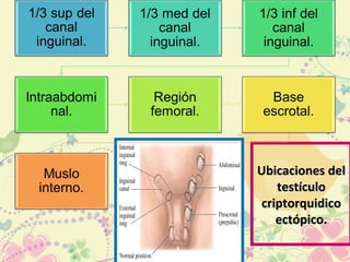 Ubicaciones delUbicaciones del
testículotestículo
criptorquidicocriptorquidico
ectópico.ectópico.
