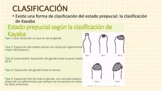 I G : s t u d y w i t h a r t
CLASIFICACIÓN
• Existe una forma de clasificación del estado prepucial: la clasificación
de Kayaba
 