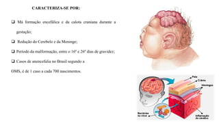 CARACTERIZA-SE POR:
 Má formação encefálica e da calota craniana durante a
gestação;
 Redução do Cerebelo e da Meninge;
 Período da malformação, entre o 16º e 26º dias de gravidez;
 Casos de anencefalia no Brasil segundo a
OMS, é de 1 caso a cada 700 nascimentos.
 