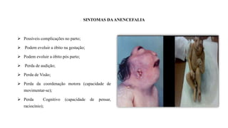  Possíveis complicações no parto;
 Podem evoluir a óbito na gestação;
 Podem evoluir a óbito pós parto;
 Perda de audição;
 Perda de Visão;
 Perda da coordenação motora (capacidade de
movimentar-se);
 Perda Cognitivo (capacidade de pensar,
raciocínio);
SINTOMAS DAANENCEFALIA
 