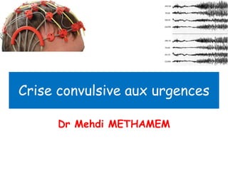 Crise convulsive aux urgences  Dr Mehdi METHAMEM  