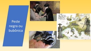 Peste
negra ou
bubônica
 