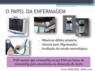 O PAPEL DA ENFERMAGEM
- Observar débito urinário;
- Atentar para Hipotensão;
- Avaliação do estado neurológico;
PAD menor que 110mmHg ou em PAS em torno de
100mmHg para aneurisma ou dissecção de Aorta
Fonte: SMELTZER, BARE, 2012.
 