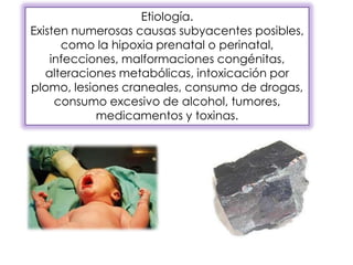 Etiología.
Existen numerosas causas subyacentes posibles,
como la hipoxia prenatal o perinatal,
infecciones, malformaciones congénitas,
alteraciones metabólicas, intoxicación por
plomo, lesiones craneales, consumo de drogas,
consumo excesivo de alcohol, tumores,
medicamentos y toxinas.
 