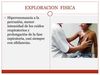 EXPLORACION  FISICA Hiperresonancia a la percusión, menor intensidad de los ruidos respiratorios y prolongación de la fase espiratoria, casi siempre con sibilancias.